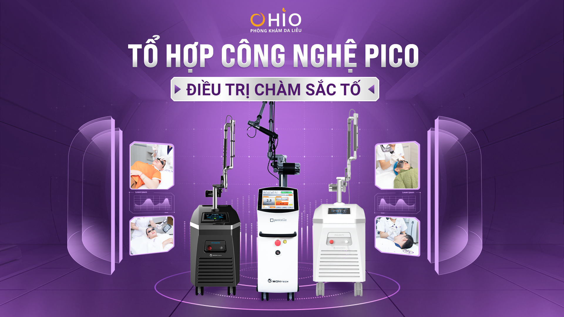 Xóa chàm bớt sắc tố tổ hợp công nghệ PICO hiệu quả – an toàn