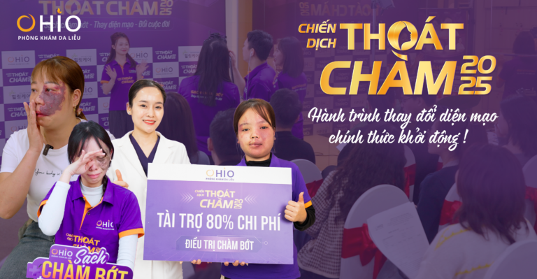 Chiến dịch “Thoát Chàm 2025” bước vào giai đoạn điều trị – Cuộc hành trình thay đổi diện mạo chính thức khởi động - Phòng khám da liễu OHIO Chiến dịch “Thoát Chàm 2025” bước vào giai đoạn điều trị – Cuộc hành trình thay đổi diện mạo chính thức khởi động