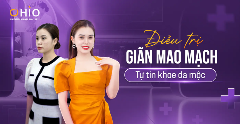Bí quyết hết giãn mao mạch vùng má – mũi của chị Thu Hằng