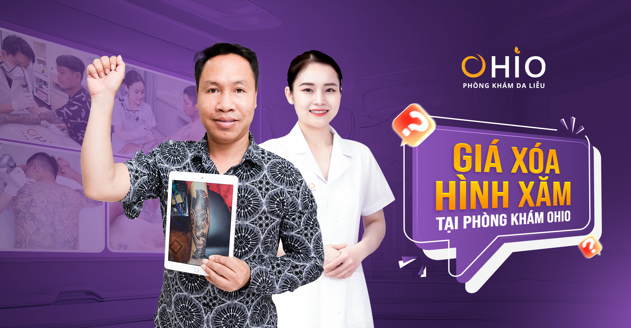 Giá xóa hình xăm tại Phòng khám da liễu OHIO? Các yếu tố ảnh hưởng đến giá