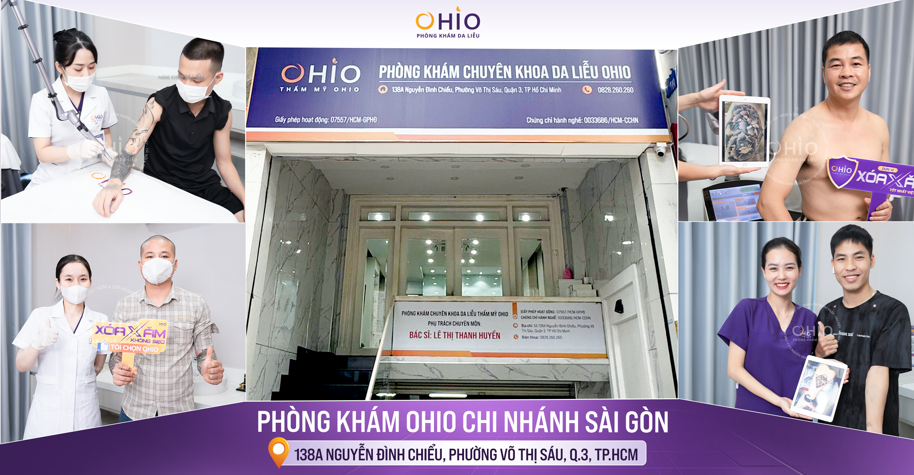 Địa chỉ xóa xăm uy tín tại Sài Gòn