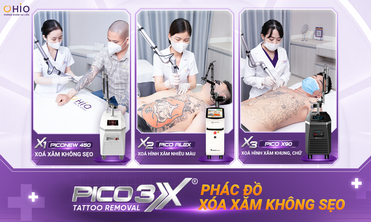 Pico 3X phác đồ Xóa xăm toàn diện đạt chuẩn FDA Hoa Kỳ
