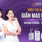 Chị Minh Hoa: Cảm ơn OHIO đã giúp tôi điều trị giãn mao mạch chân