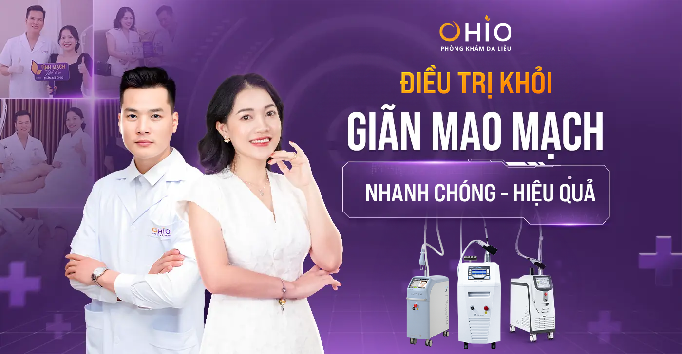 Chị Minh Hoa: Cảm ơn OHIO đã giúp tôi điều trị giãn mao mạch chân