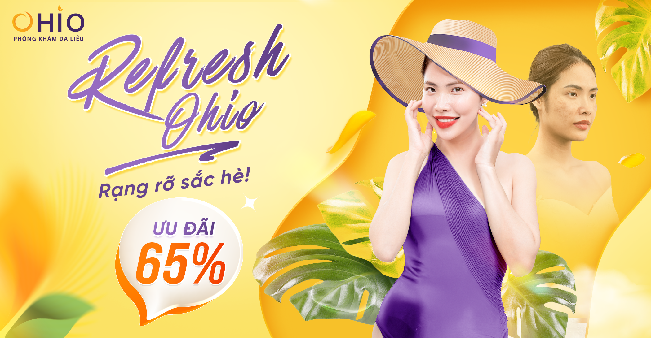 REFRESH OHIO – RẠNG RỠ SẮC HÈ