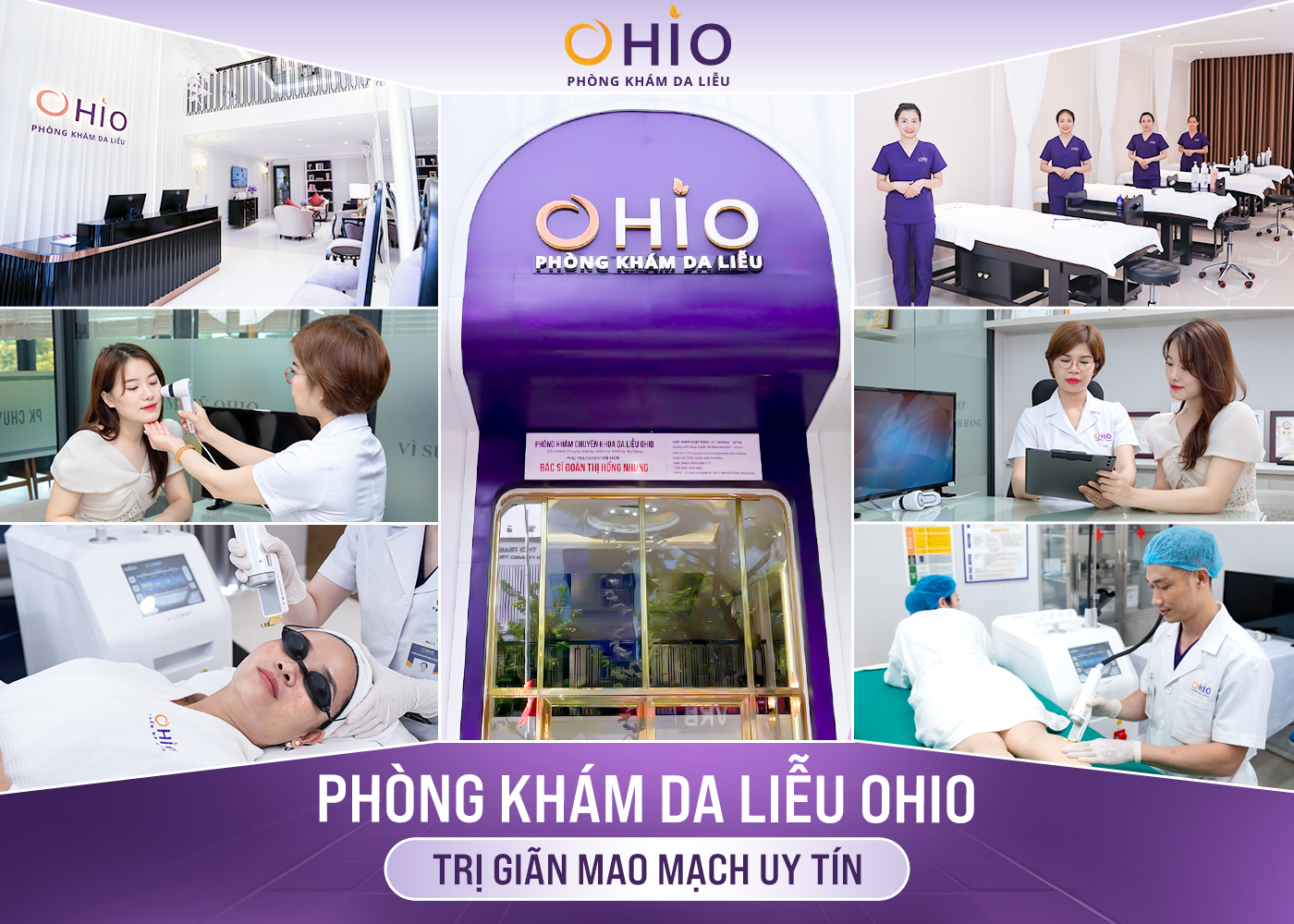 Trị giãn mao mạch ở đâu uy tín?