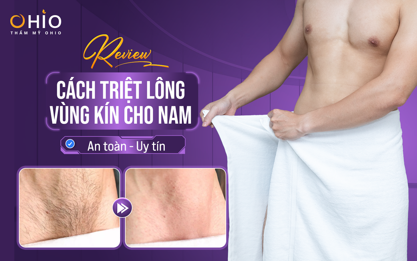 Review cách triệt lông vùng kín cho nam an toàn, uy tín?