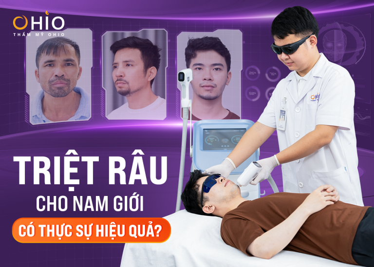 Triệt râu, Triệt lông cho Nam có thực sự hiệu quả?