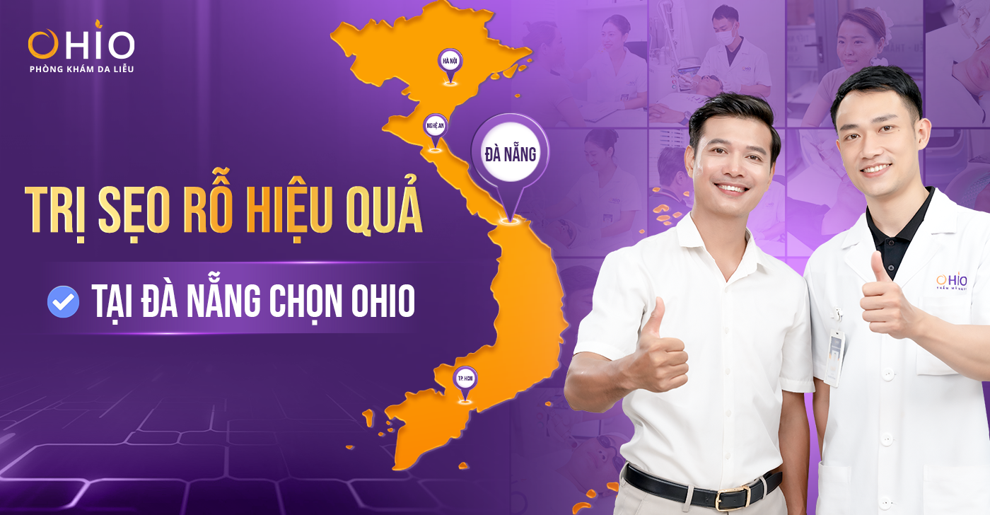 Trị Sẹo Rỗ Hiệu Quả Tại Đà Nẵng: Phòng Khám Da Liễu OHIO – Địa Chỉ Uy Tín Được Sở Y Tế Cấp Phép