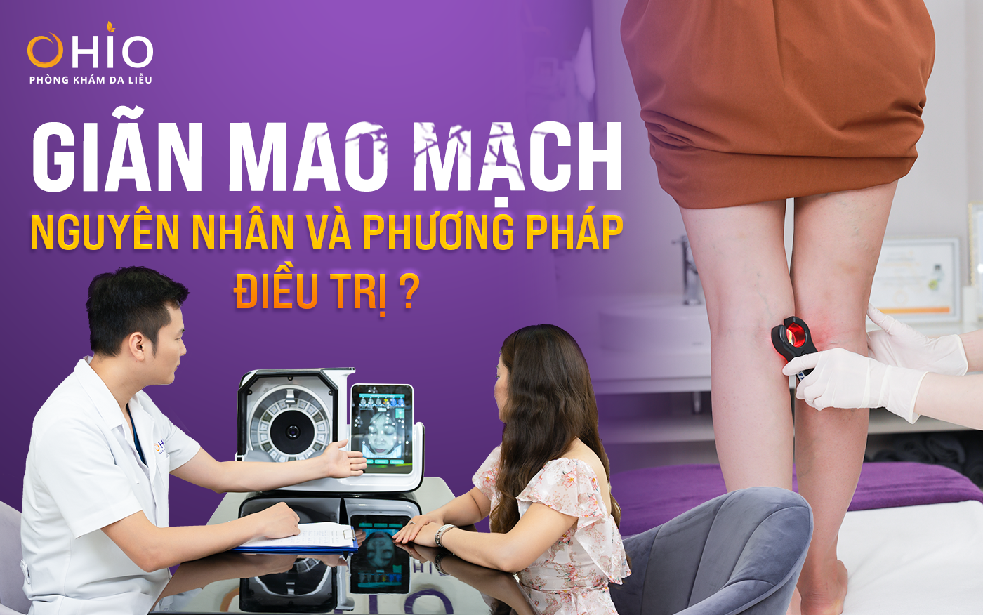 Giãn mao mạch: Nguyên nhân và phương pháp điều trị?
