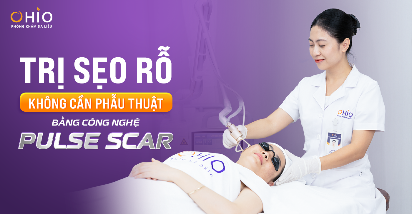 TRỊ SẸO RỖ KHÔNG CẦN PHẪU THUẬT BẰNG CÔNG NGHỆ PULSE SCAR