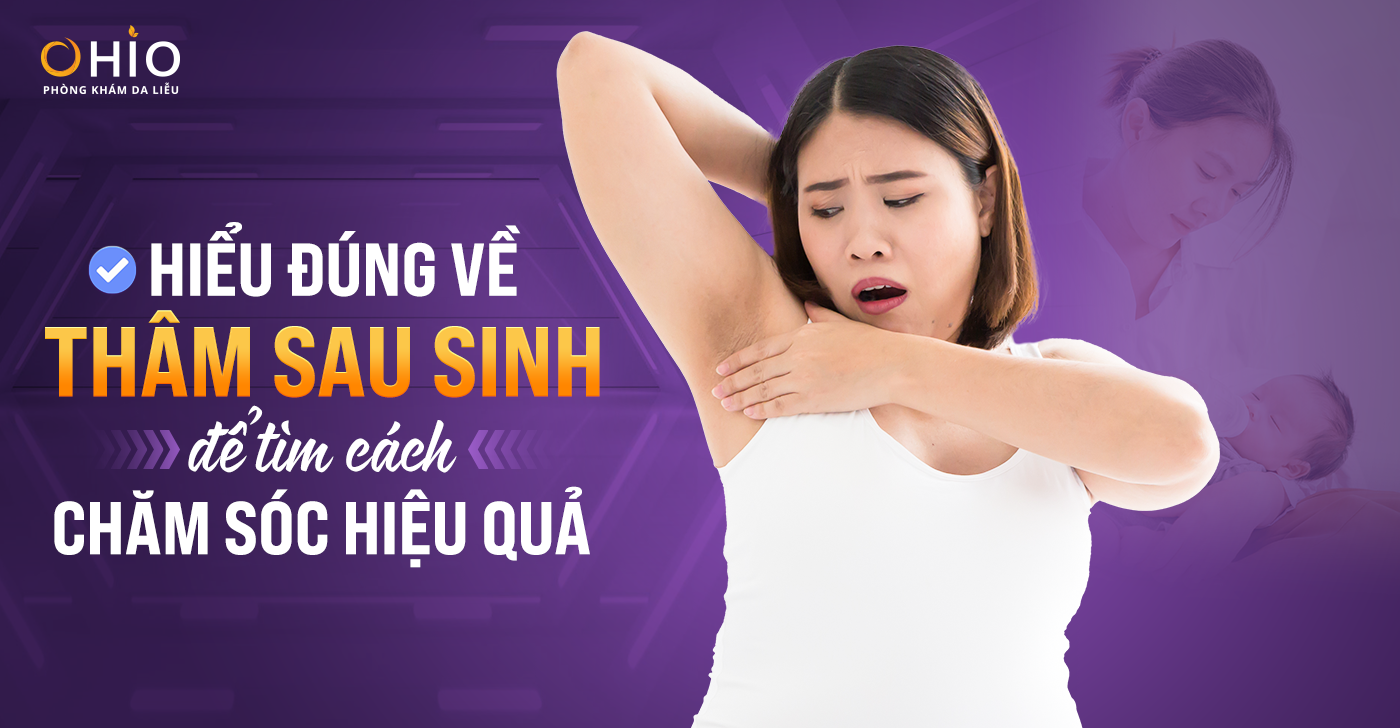 Hiểu đúng về thâm sau sinh để tìm cách chăm sóc hiệu quả