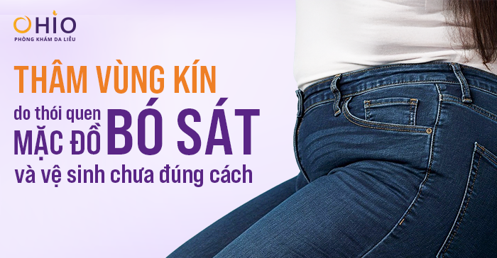 Thâm vùng kín do thói quen mặc đồ bó sát và vệ sinh chưa đúng cách - Phòng khám da liễu OHIO Thâm vùng kín do thói quen mặc đồ bó sát và vệ sinh chưa đúng cách