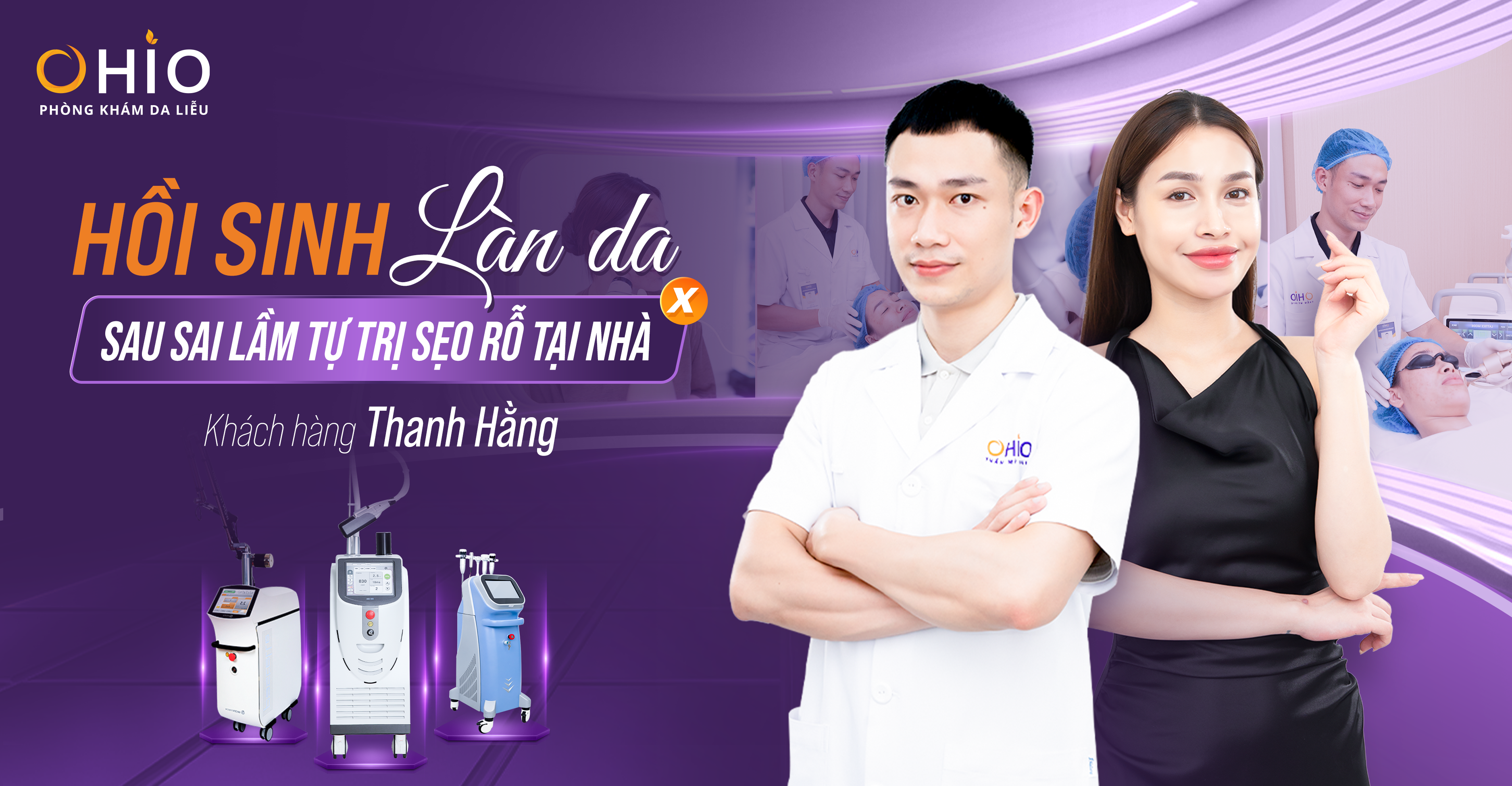 Sai lầm khi tự trị sẹo rỗ – Hành trình hồi sinh làn da của chị Thanh Hằng tại OHIO