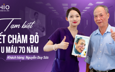 Xóa Sạch Chàm Đỏ, U Máu 70 Năm tại OHIO