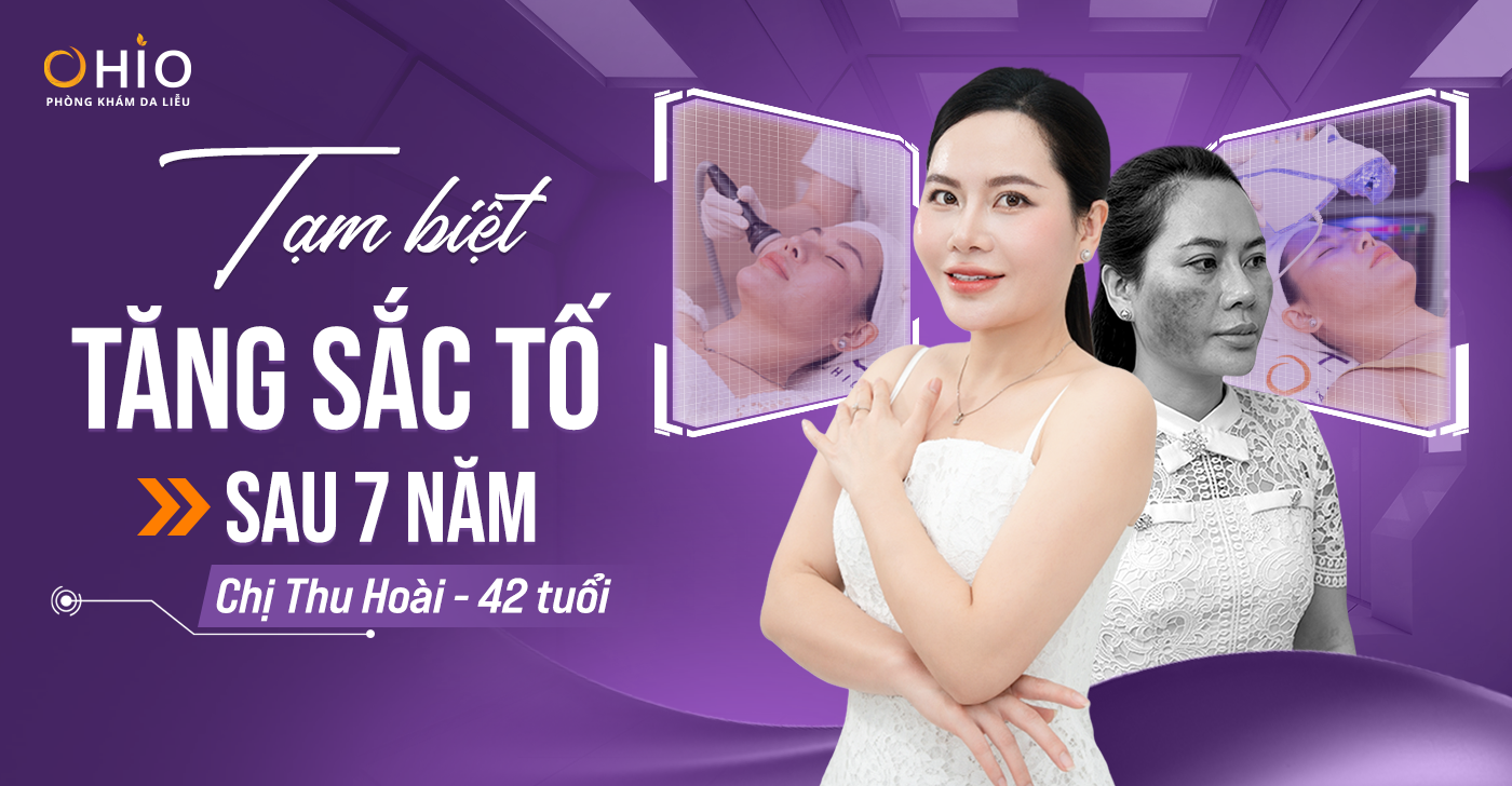 Tạm biệt tăng sắc tố sau 7 năm — Hành trình tìm lại chính mình của chị Thu Hoài