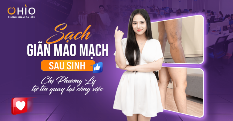 Giải pháp trị giãn mao mạch sau sinh giúp chị Phương Ly tự tin quay lại công việc