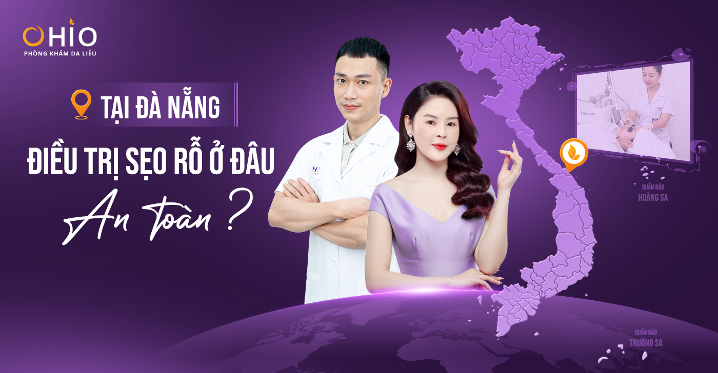 Điều trị sẹo rỗ tại Đà Nẵng: Làm sao chọn đúng địa chỉ an toàn, tránh “tiền mất, tật mang”?