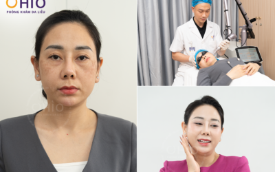 SẮP DIỄN RA: “SKIN RESET DAY” – CƠ HỘI TÁI TẠO LÀN DA TOÀN DIỆN TRONG CHIẾN DỊCH SUMMER RESET TẠI OHIO