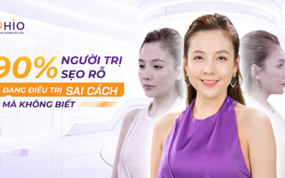 90% Người Trị Sẹo Rỗ Đang Điều Trị Sai Cách Mà Không Biết