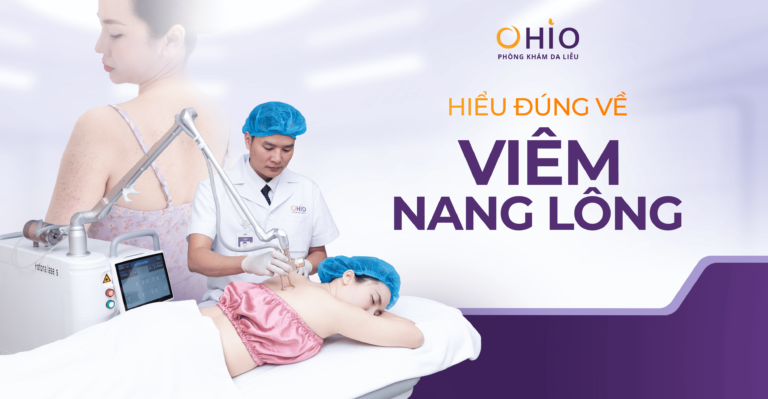 Viêm nang lông: Nhận biết sớm, phòng ngừa và hướng điều trị đúng cách - Phòng khám da liễu OHIO Viêm nang lông: Nhận biết sớm, phòng ngừa và hướng điều trị đúng cách
