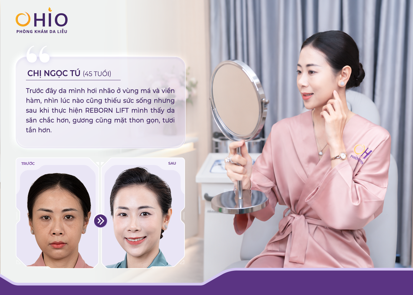 Reborn Lift - Phác đồ trẻ hóa tái cấu trúc da toàn diện cho phụ nữ hiện đại - Phòng khám da liễu OHIO Reborn Lift - Phác đồ trẻ hóa tái cấu trúc da toàn diện cho phụ nữ hiện đại
