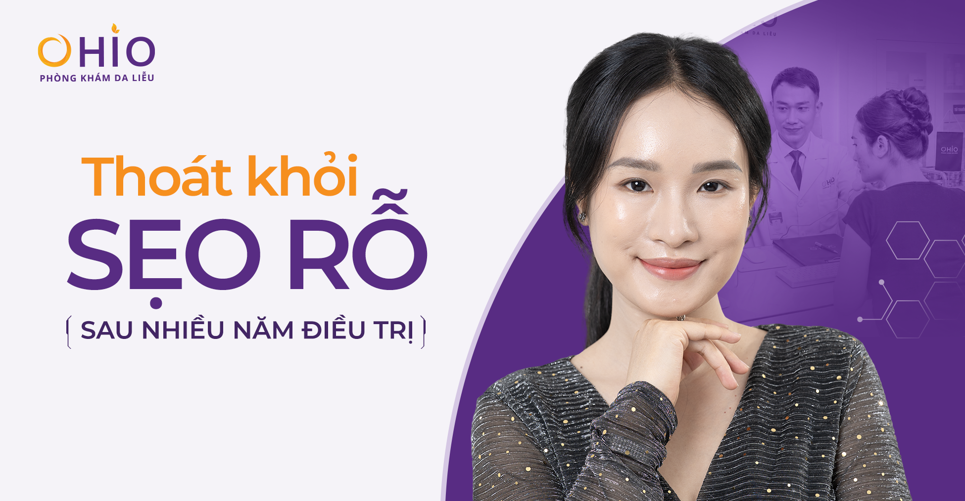 Hành Trình Thoát Khỏi Sẹo Rỗ Sau Nhiều Năm Loay Hoay Điều Trị Của Giảng Viên Yoga Ánh Ngọc