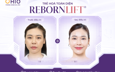 Trẻ hóa da chuyên sâu