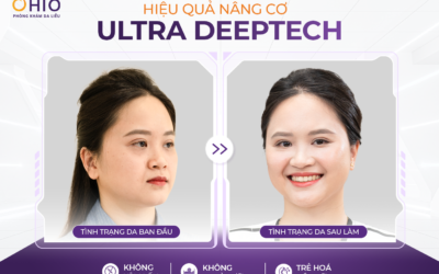 Nâng cơ săn chắc, trẻ hóa da