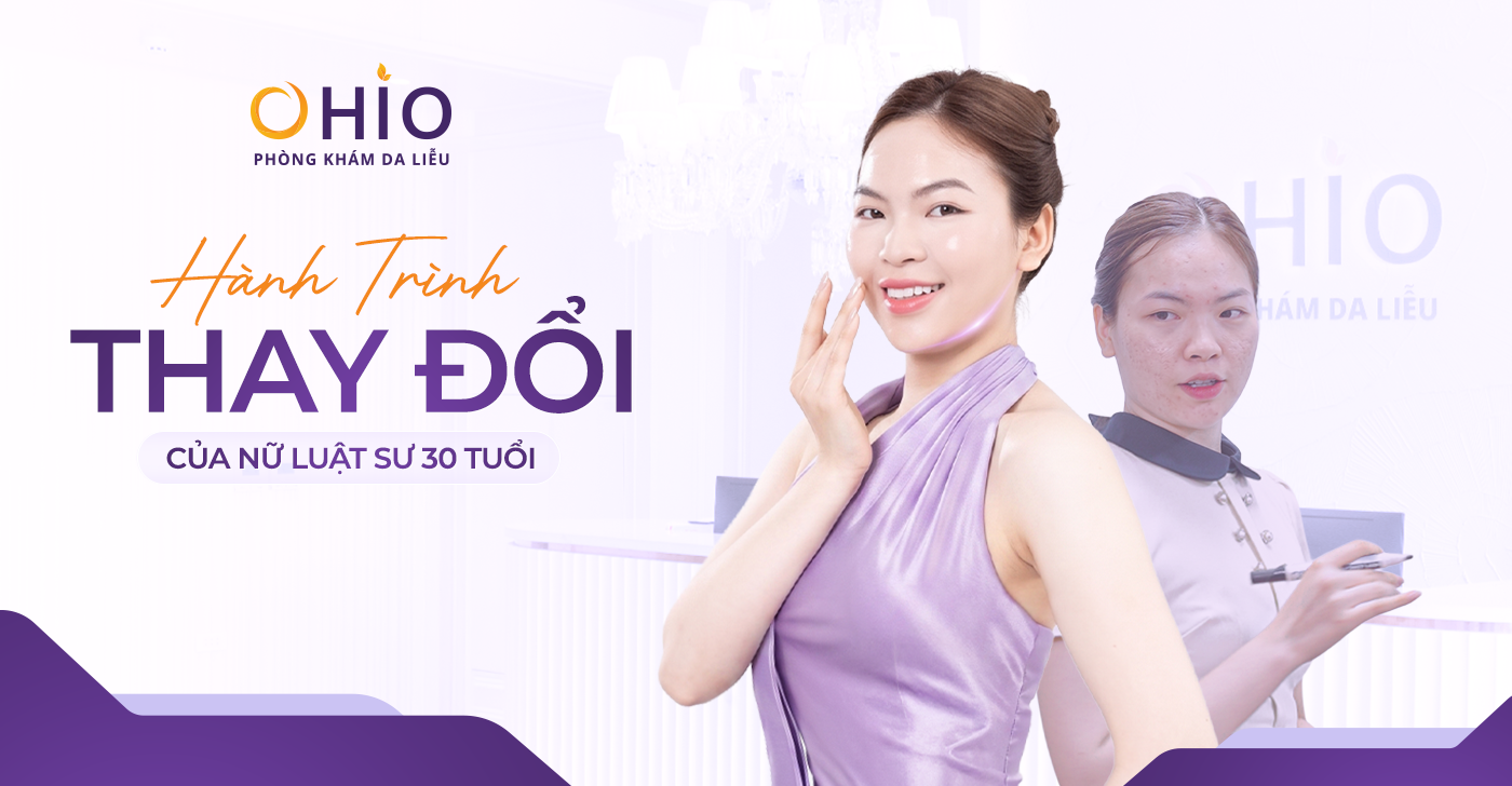 Hành Trình Thay Đổi Của Nữ Luật Sư 30 Tuổi – “Tôi Từng Né Nhìn Thẳng Vào Khách Hàng Chỉ Vì Sẹo Rỗ”