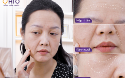 Trẻ hóa và tái tạo làn da