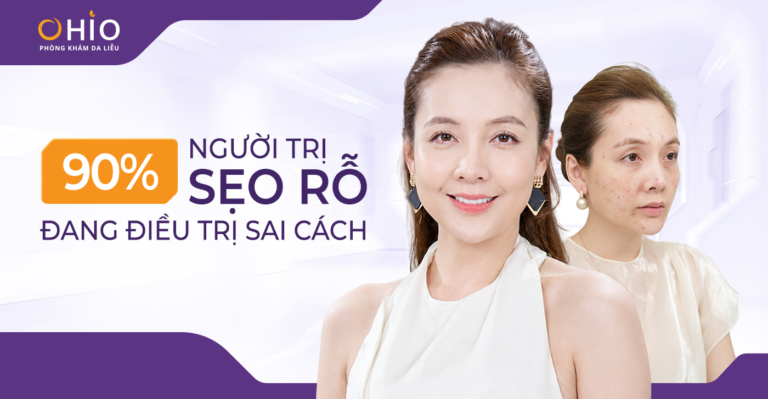 Sẹo Rỗ Công Sở: Áp Lực Ngoại Hình Thầm Lặng Của Người Trẻ Thành Đạt - Phòng khám da liễu OHIO Sẹo Rỗ Công Sở: Áp Lực Ngoại Hình Thầm Lặng Của Người Trẻ Thành Đạt