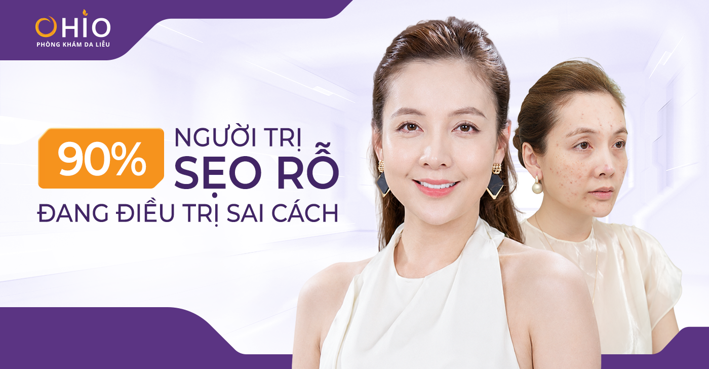 Sẹo Rỗ Công Sở: Áp Lực Ngoại Hình Thầm Lặng Của Người Trẻ Thành Đạt