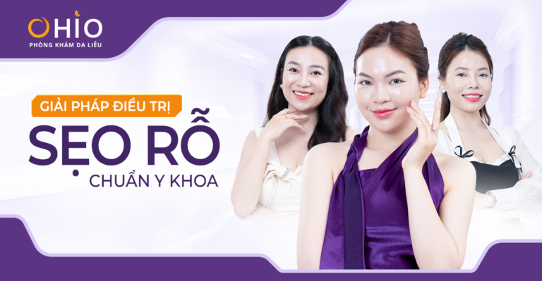 OHIO Và Hướng Đi Mới Trong Điều Trị Sẹo Rỗ: Không Chỉ Làm Đầy Sẹo, Mà Tái Sinh Sự Tự Tin - Phòng khám da liễu OHIO OHIO Và Hướng Đi Mới Trong Điều Trị Sẹo Rỗ: Không Chỉ Làm Đầy Sẹo, Mà Tái Sinh Sự Tự Tin