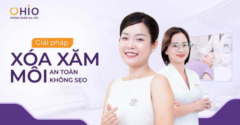 Giải pháp xóa xăm môi an toàn và không để lại sẹo - Phòng khám da liễu OHIO Giải pháp xóa xăm môi an toàn và không để lại sẹo