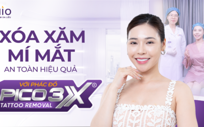 Xóa xăm mí mắt an toàn hiệu quả với phác đồ Pico 3X