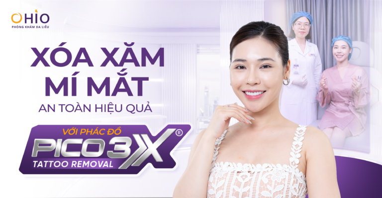 Xóa xăm mí mắt an toàn hiệu quả với phác đồ Pico 3X