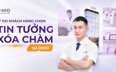 Vì sao OHIO được nhiều khách hàng lựa chọn trong điều trị chàm bớt?