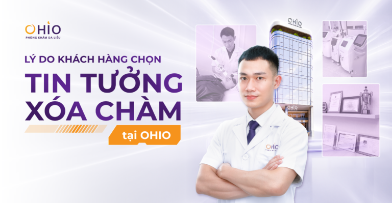 Vì sao OHIO được nhiều khách hàng lựa chọn trong điều trị chàm bớt?