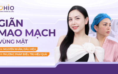Giãn mao mạch ở mặt: Nguyên nhân, dấu hiệu và phương pháp điều trị hiệu quả