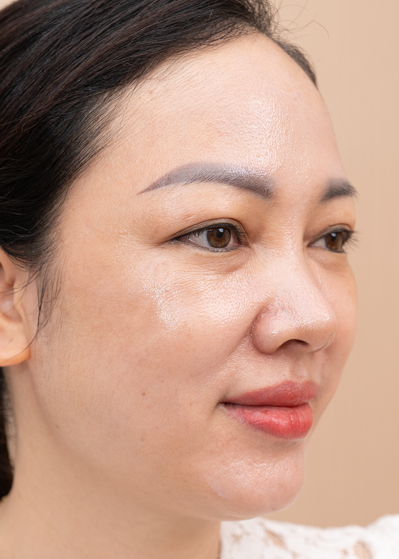 Tàn nhang Chị Nguyễn Hà | Kinh doanh - Sau