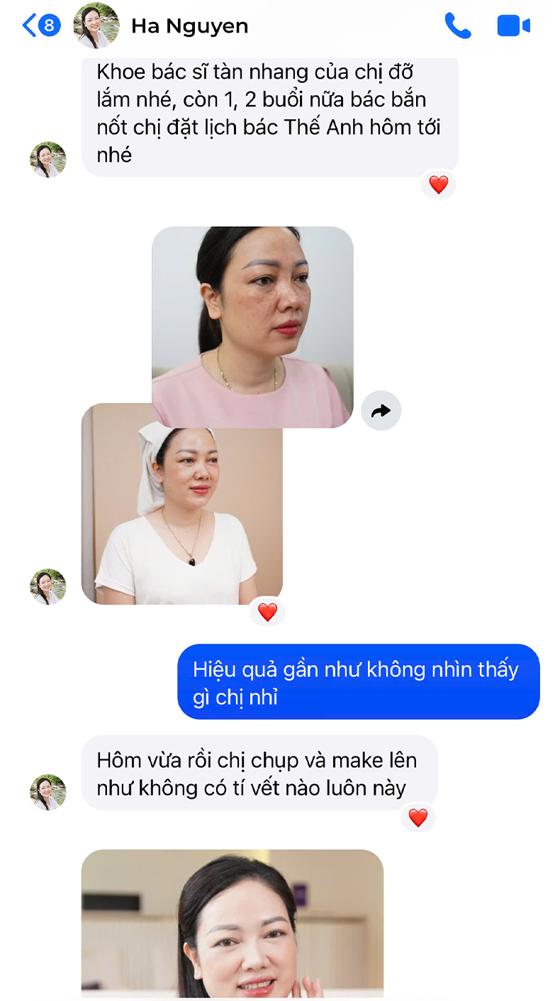 Tàn nhang Chị Nguyễn Hà | Kinh doanh