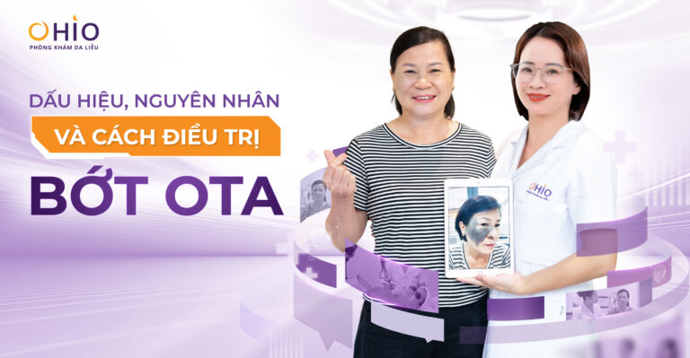 Chàm bớt OTA là gì? Nguyên nhân hình thành và phương pháp điều trị hiện nay - Phòng khám da liễu OHIO Chàm bớt OTA là gì? Nguyên nhân hình thành và phương pháp điều trị hiện nay