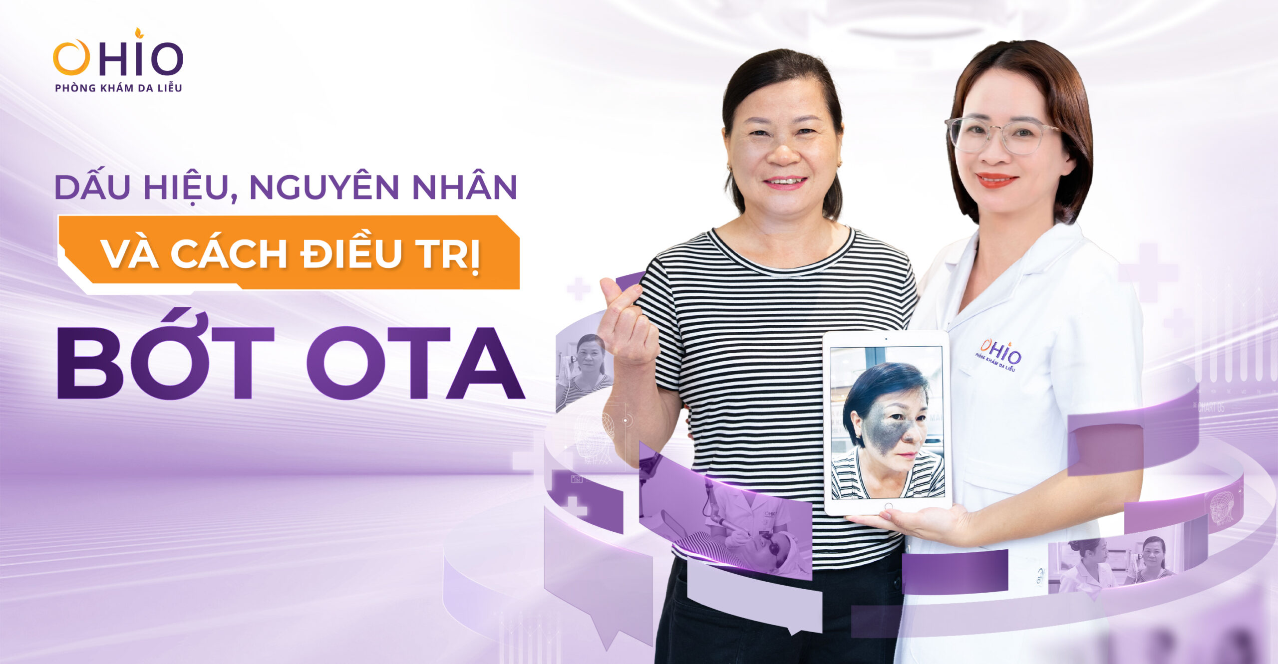 Chàm bớt OTA là gì? Nguyên nhân hình thành và phương pháp điều trị hiện nay