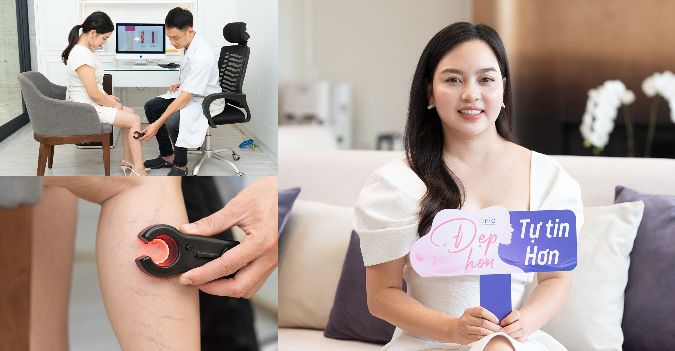 Doanh Nhân Thu Phương” thoát” giãn mao mạch thành công nhờ OHIO