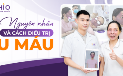 U Máu Là Gì? Dấu Hiệu Nhận Biết, Nguyên Nhân Và Phương Pháp Điều Trị Hiện Nay