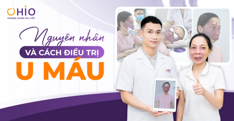 U Máu Là Gì? Dấu Hiệu Nhận Biết, Nguyên Nhân Và Phương Pháp Điều Trị Hiện Nay
