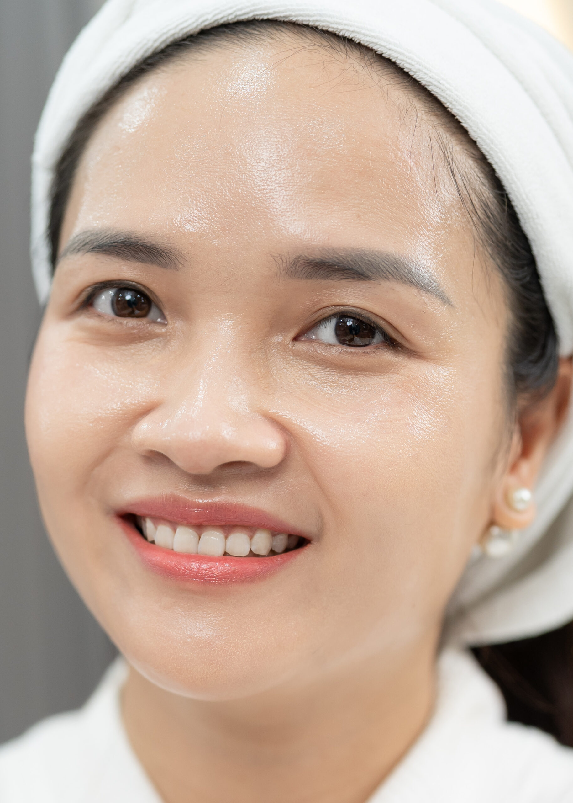 Giãn mao mạch mặt Chị Mỹ Trang | Kinh doanh - Sau