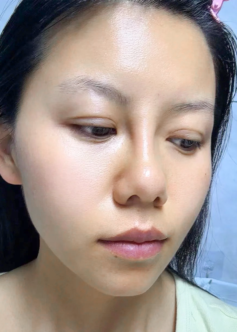 Da khô Chị Diệu Nhi - Sau