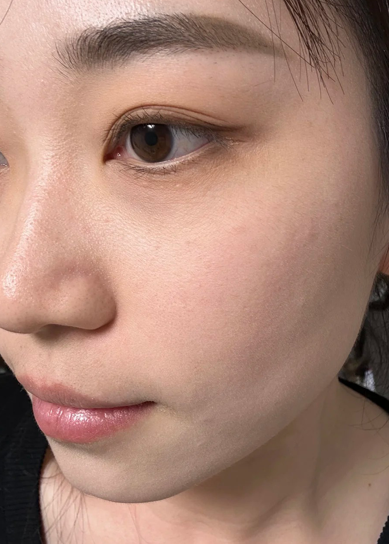 Da thường Chị Thu Uyên - Sau